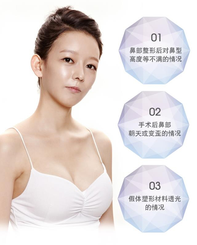 鼻子修复术