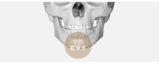 无下巴