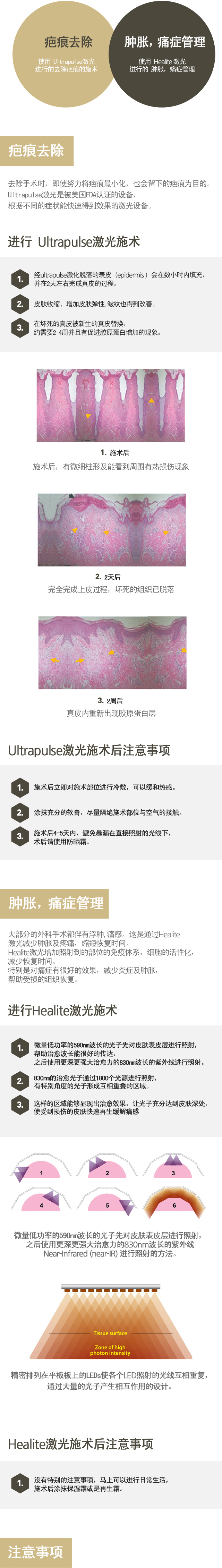可以去除异物质手术的部位 / 使用自体脂肪移植的复原方法 / 使用假体的复原方法