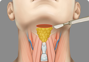 디자인 모습